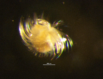 Planktonic organism with iridescent ciliary bands on a dark microscope field