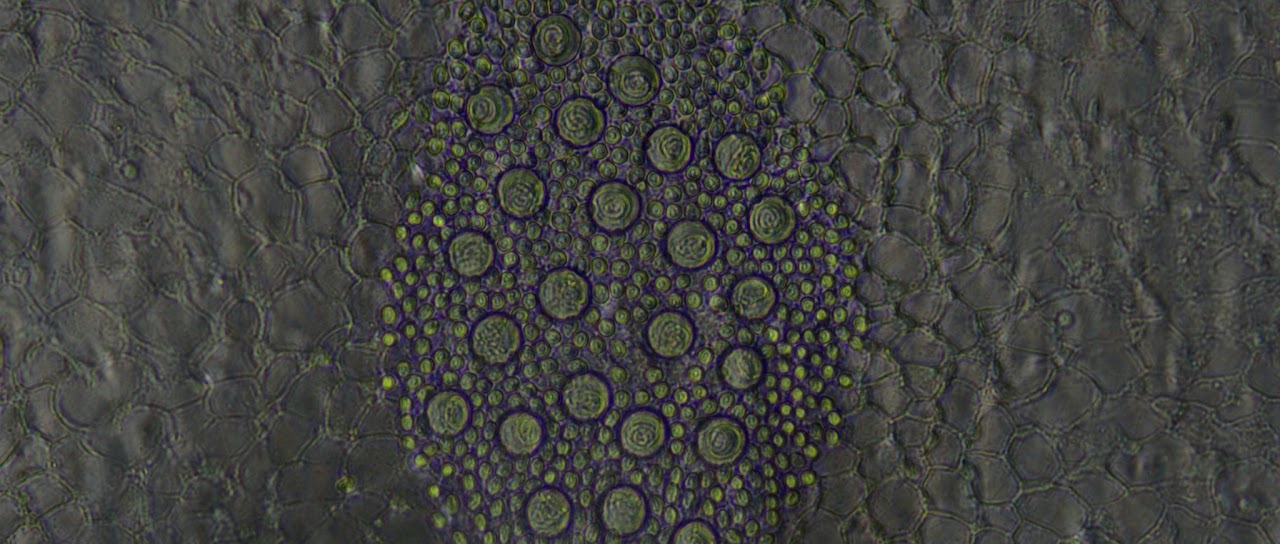 Micrograph of a dense cluster of nematocyst capsules within jellyfish tissue