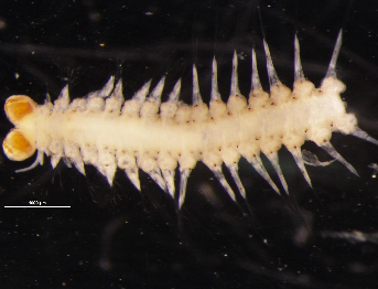 Polychaete worm with paired eyes and bristled segments seen under the microscope