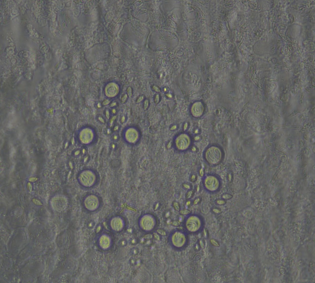 Magnified micrograph showing round and oval nematocyst capsules