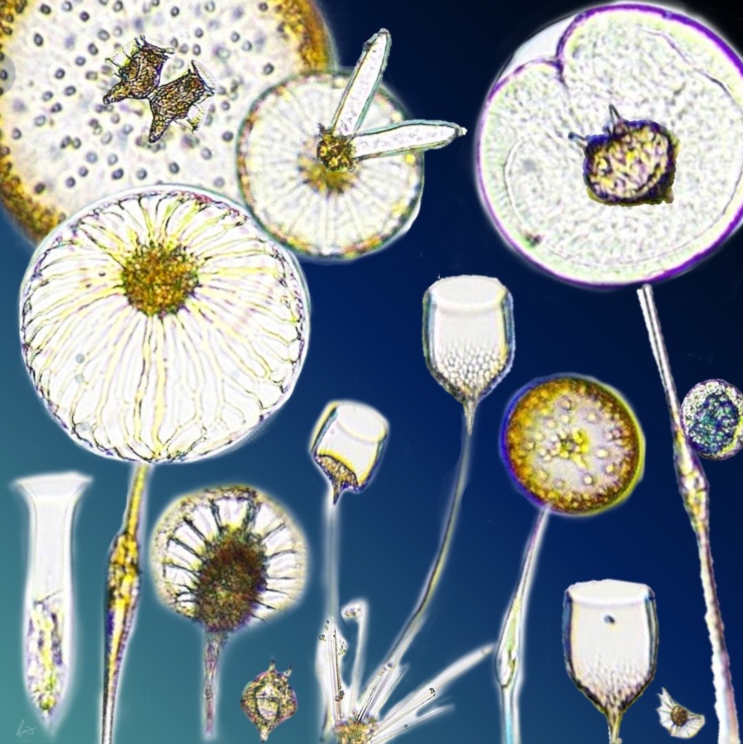 Plankton sample examined under a laboratory microscope