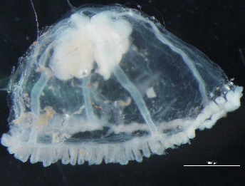 Juvenile jellyfish medusa viewed from the side under the microscope, showing bell margin and gonads